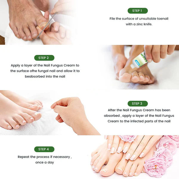 SUMIFUN - Nail Treatment Repair Gel