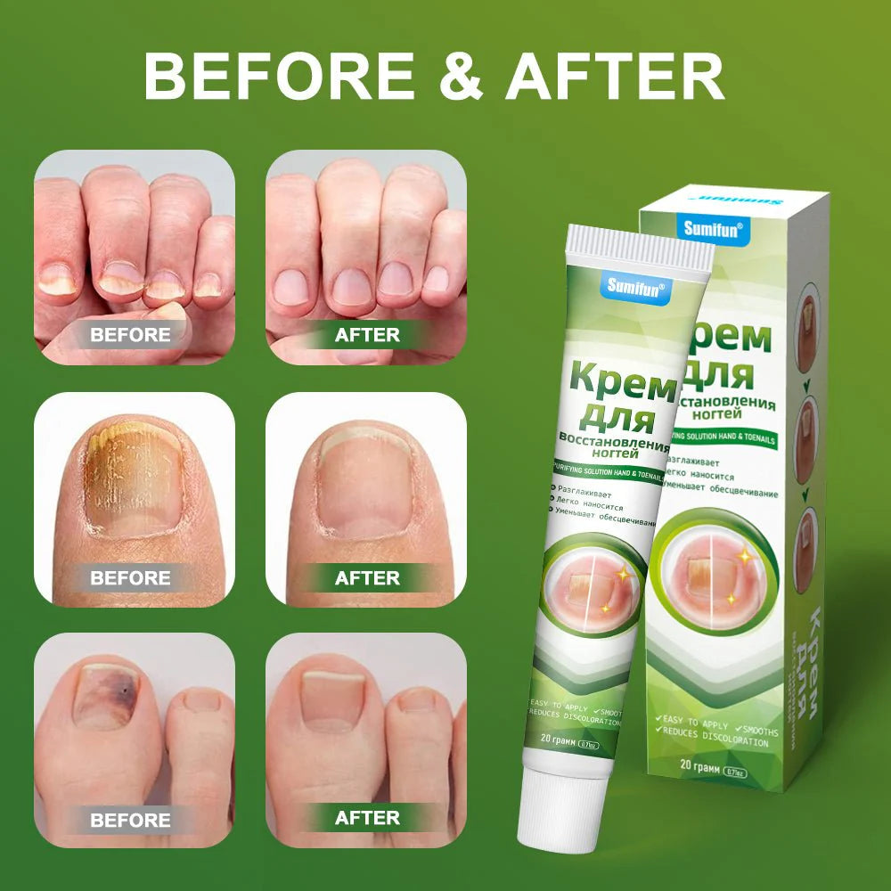 SUMIFUN - Nail Treatment Repair Gel